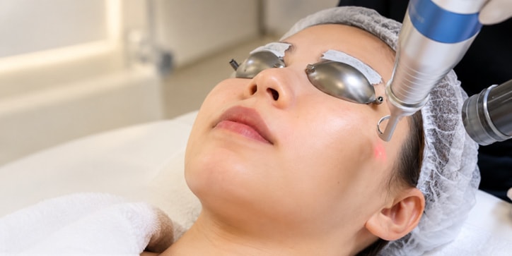Pico Laser + 1ml Rejuran Pro Infusion